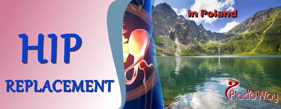 Hip Replacement in Poland, Orthopedic Surgery in Poland